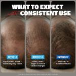 Kirkland Signature Minoxidil 5% Extra Strength Topical Solution – 6 Month Supply (Hair Regrowth Treatment)